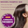 SHEIN 5% Minoxidil Shampoo Bar Deep Cleansing Of Hair And Scalp, Hair Shampoo & Conditioner