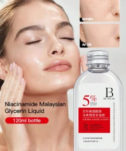 SHEIN Niacinamide & Glycerin Serum, Improves Redness, Roughness, Hydrates, Moisturizes